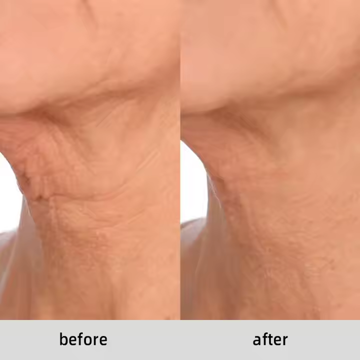 Korean Micro-Needling Ampoule Serum – 12+4 Mini Boosters