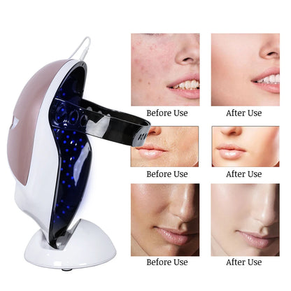 Photon Rejuvenation LED Light Beauty Mask